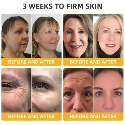 BeeTight Anti-Aging Pro-Lifting Cream - Image 4