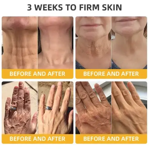 BeeTight Anti-Aging Pro-Lifting Cream - Image 5