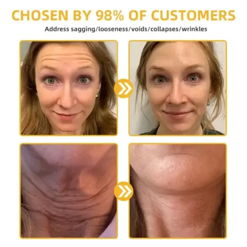 BeeTight Anti-Aging Pro-Lifting Cream - Image 6