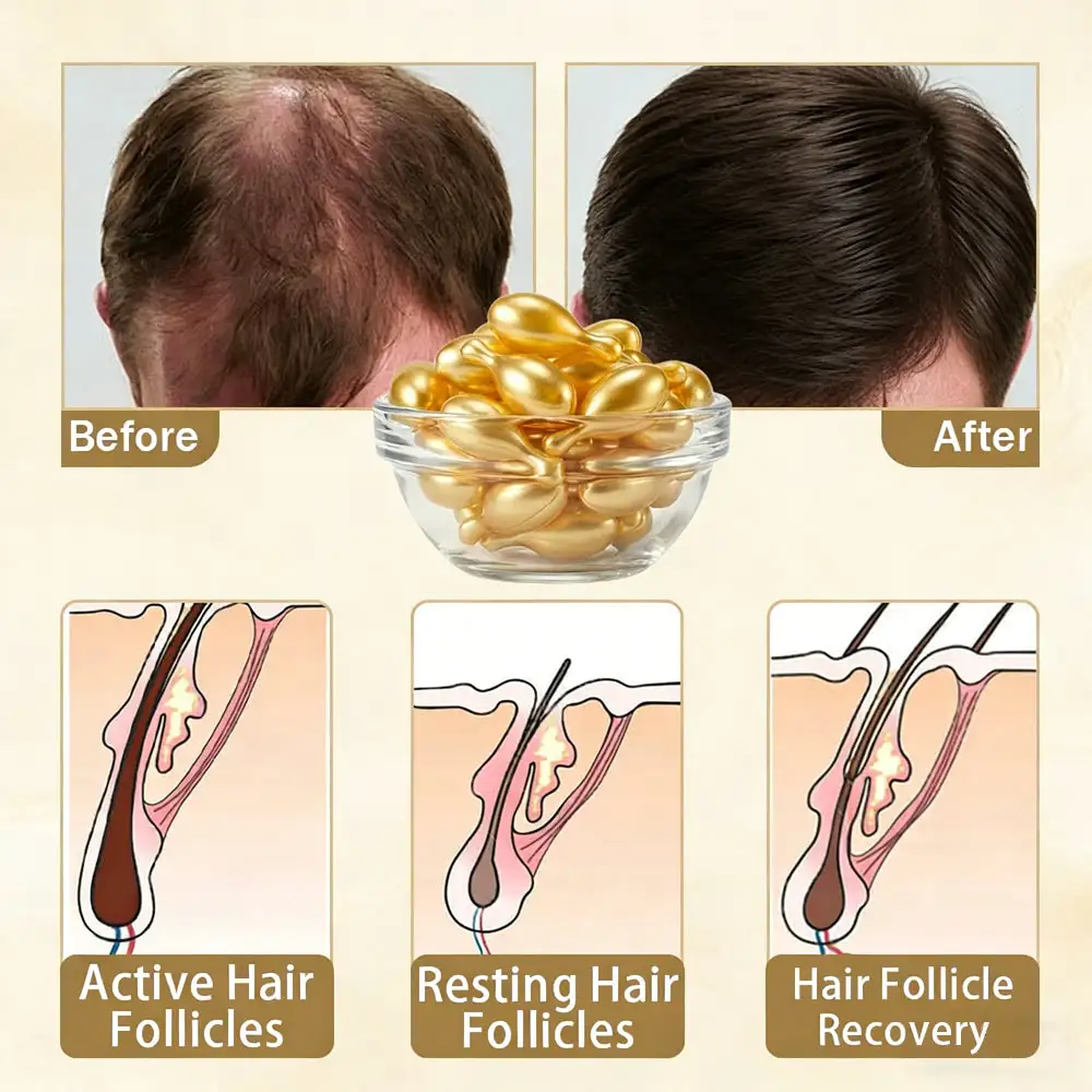 Hair Regrowth Capsules - Image 14