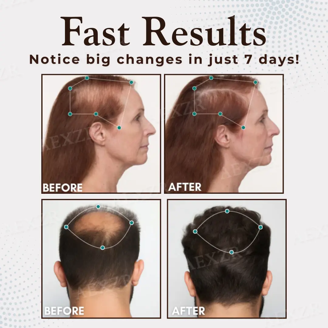 Hair Regrowth Capsules - Image 5