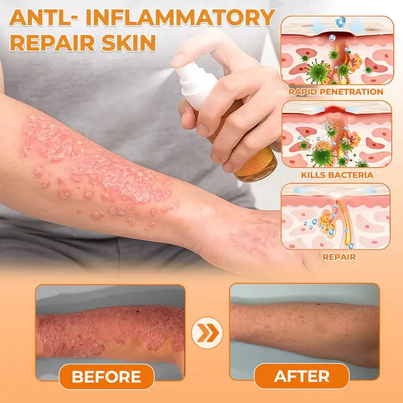 Bee Venom Antifungal & Antibacterial Spray - Image 2