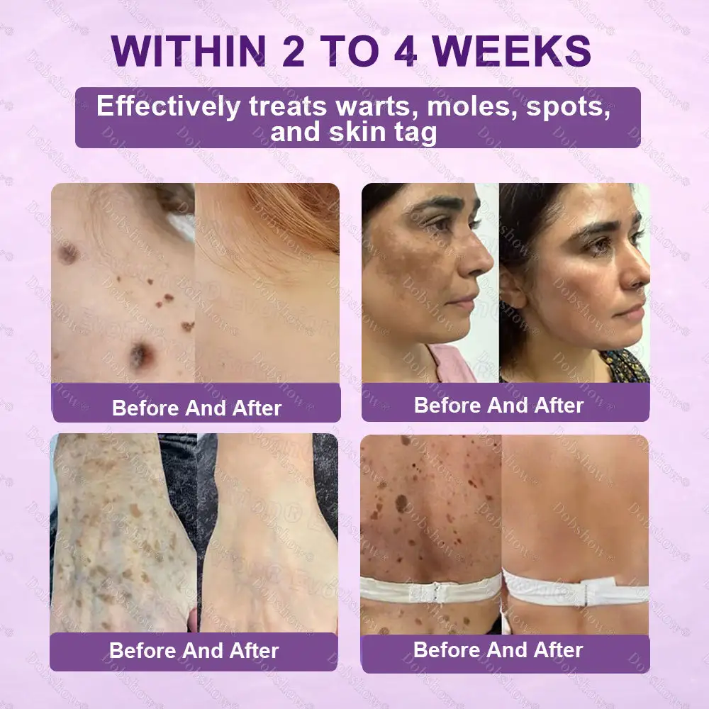 ✨Best Biotin 10-in-1 Skin Restoration Cream - Image 4