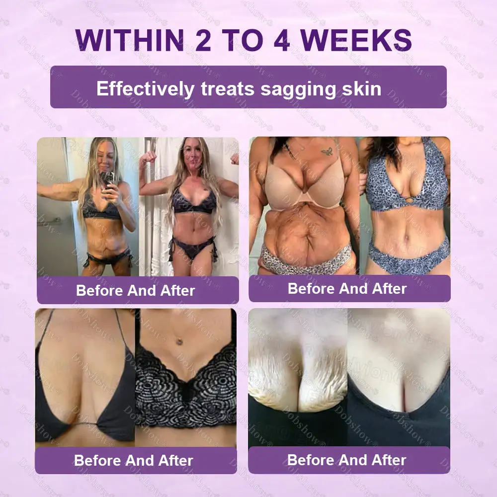 ✨Best Biotin 10-in-1 Skin Restoration Cream - Image 5