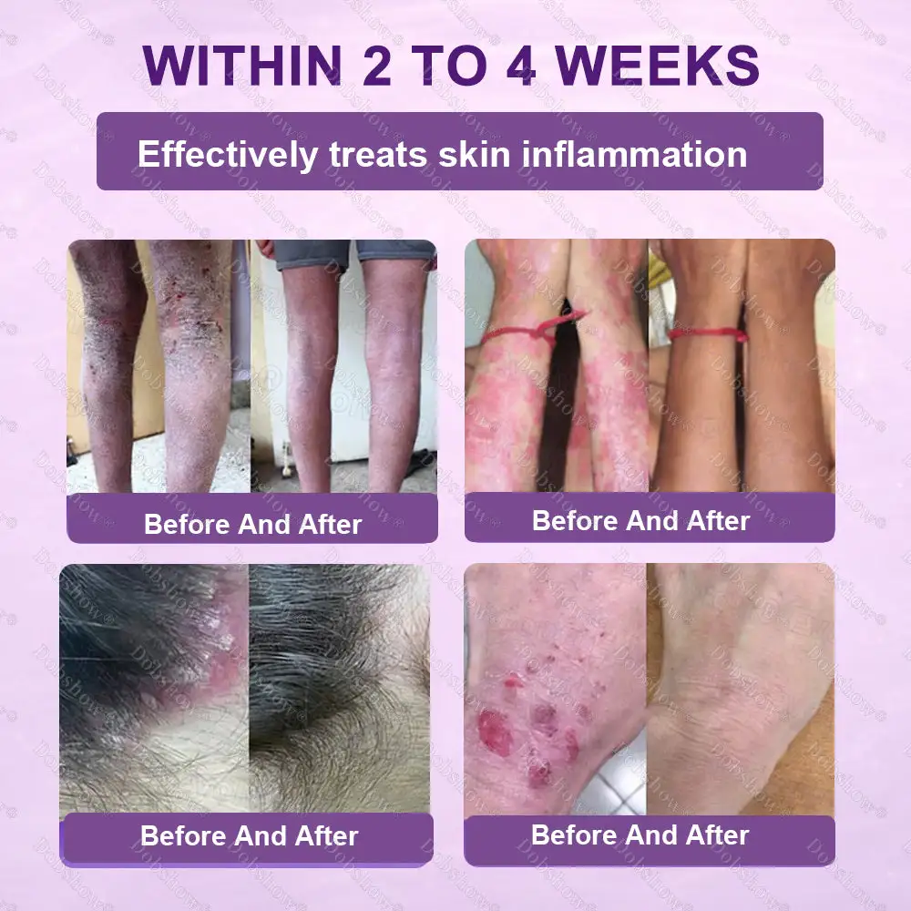 ✨Best Biotin 10-in-1 Skin Restoration Cream - Image 6