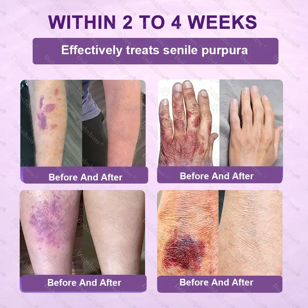 ✨Best Biotin 10-in-1 Skin Restoration Cream - Image 7