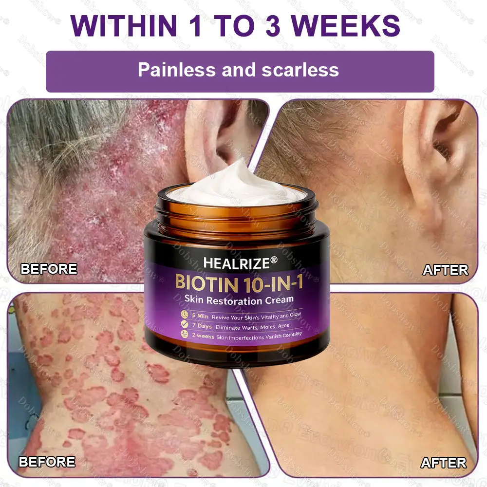 ✨Best Biotin 10-in-1 Skin Restoration Cream - Image 9