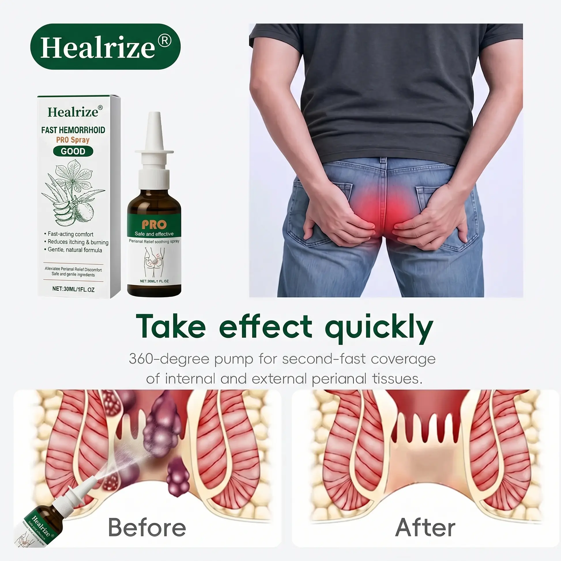 Fast Hemorrhoid PRO Spray - Image 2