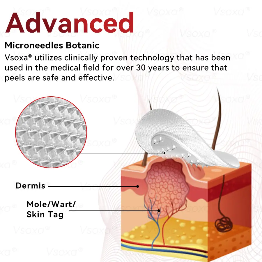 Microneedles Botanical Skin Tags Solution Patches - Image 11