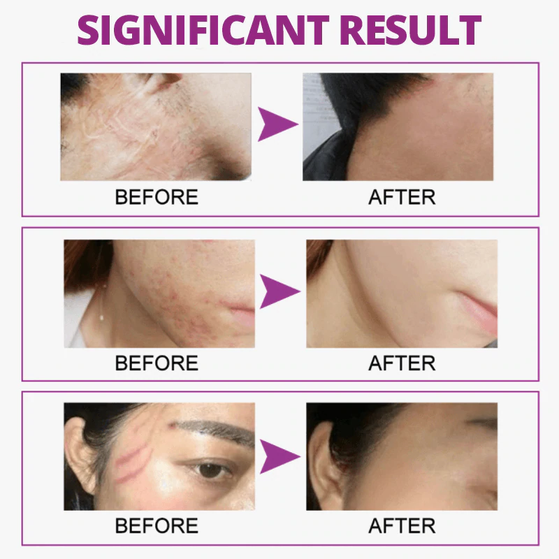 Cicatrix Healing Cream - Image 8