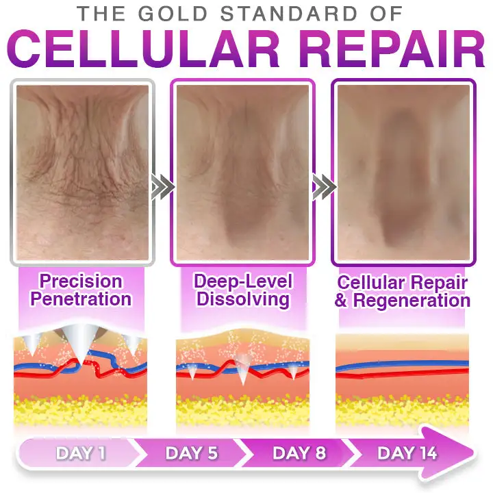 3-in-1 Microneedle Anti-Aging Patch - Image 4