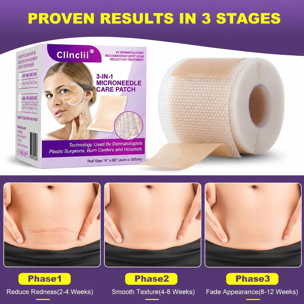 3-in-1 Microneedle Anti-Aging Patch - Image 6