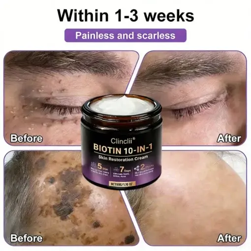 Biotin 10-in-1 Skin Restoration Cream - Image 5