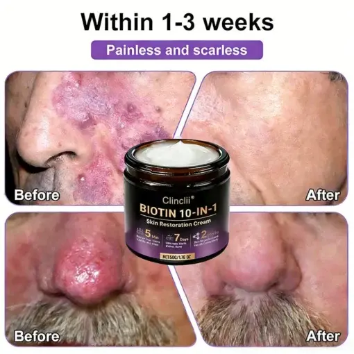 Biotin 10-in-1 Skin Restoration Cream - Image 6