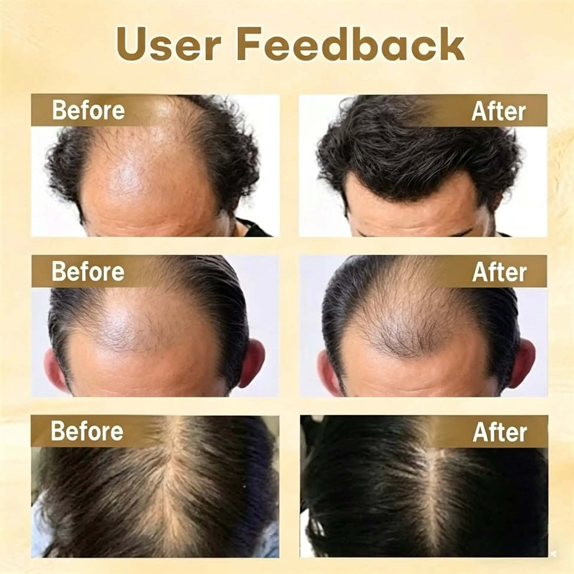 Hair Regrowth Capsules - Image 2