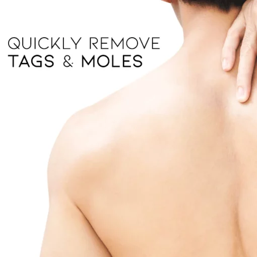 Cvreoz Bee Venom Wart and Tags Removal Treatment Spray - Image 8