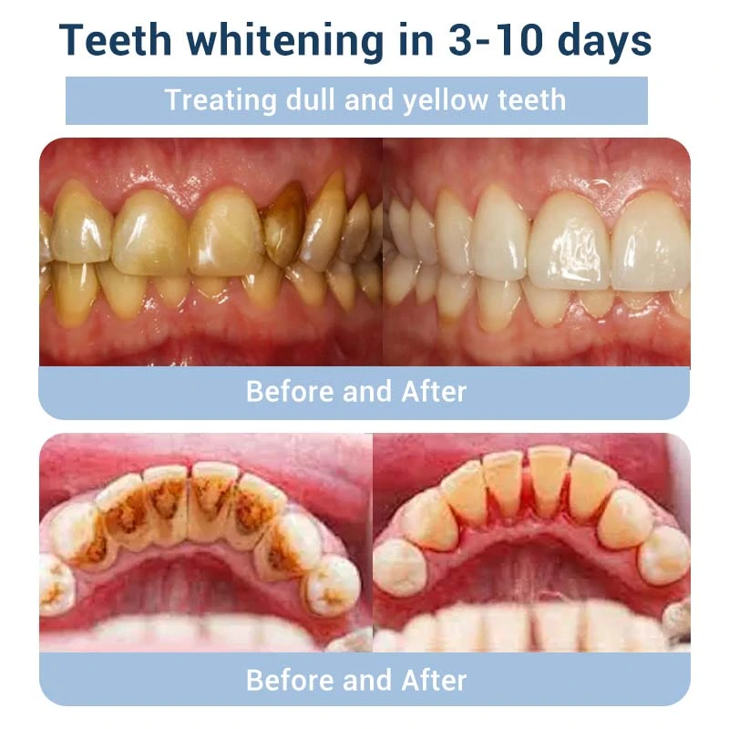 TeethRestoration Toothpaste Gel - Image 9