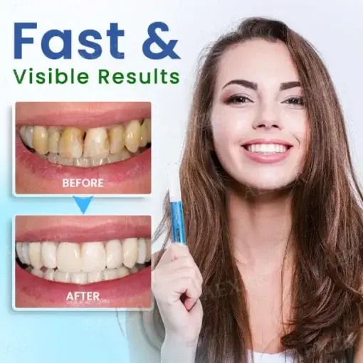 Teeth Whitening Pen - Image 2