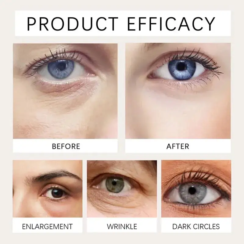 The Instant Eye Lift That Doesn't Betray You When You Smile - Image 5