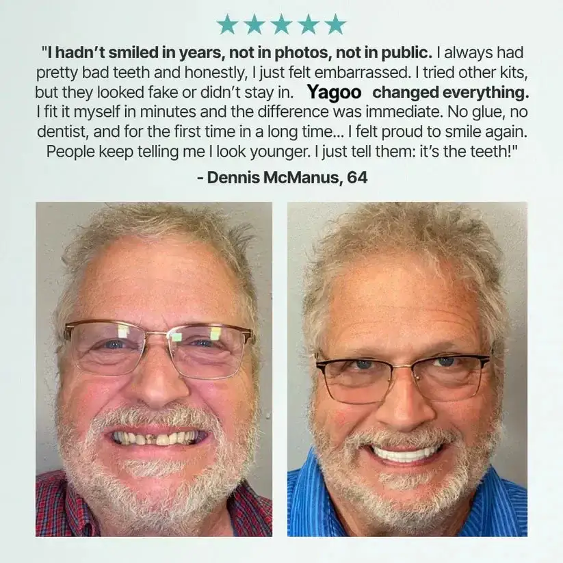 🌎Ends Today: 70% OFF! Medical Full Denture with Strong Suctiond - Image 20
