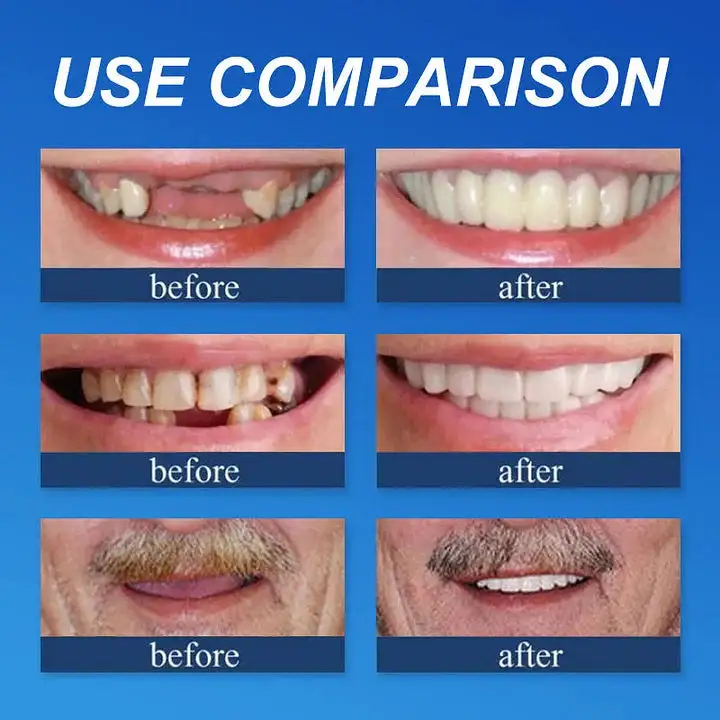 🌎Ends Today: 70% OFF! Medical Full Denture with Strong Suctiond - Image 7