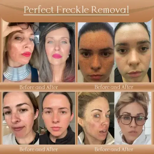 F-LIFT Anti-Wrinkle Firming Cream - Image 4