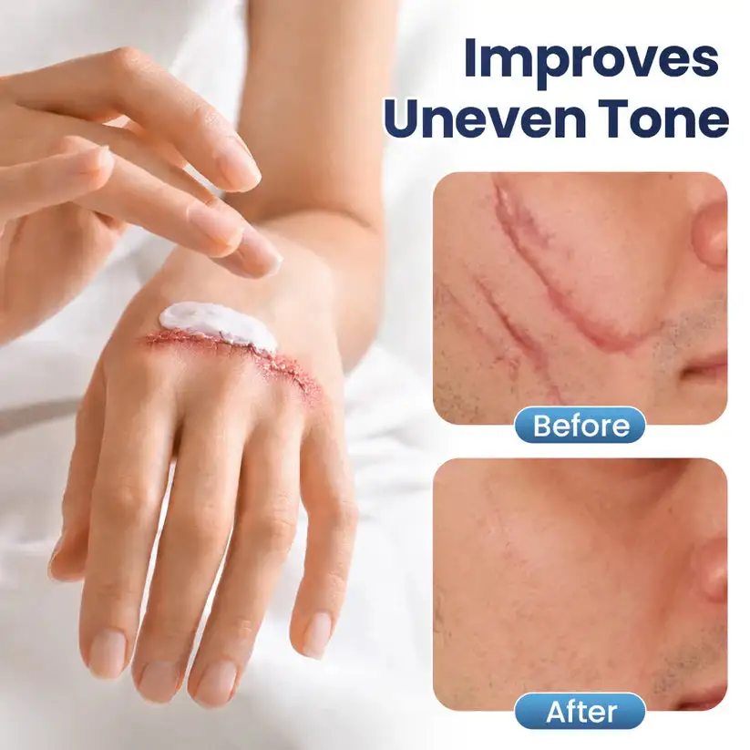 Texture Repair Gel - Image 7