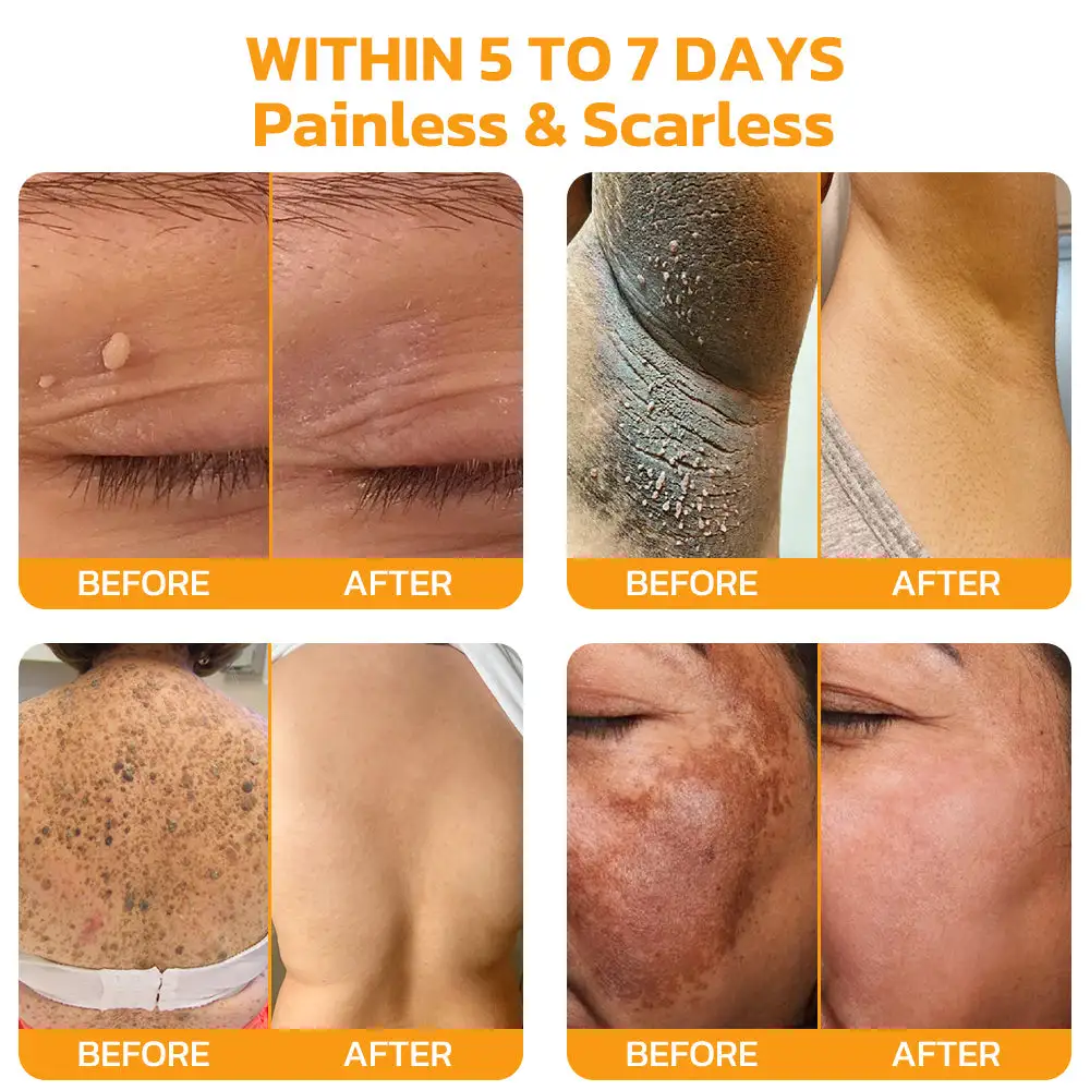 Bee Venom Skincare Treatment Pads - Image 4