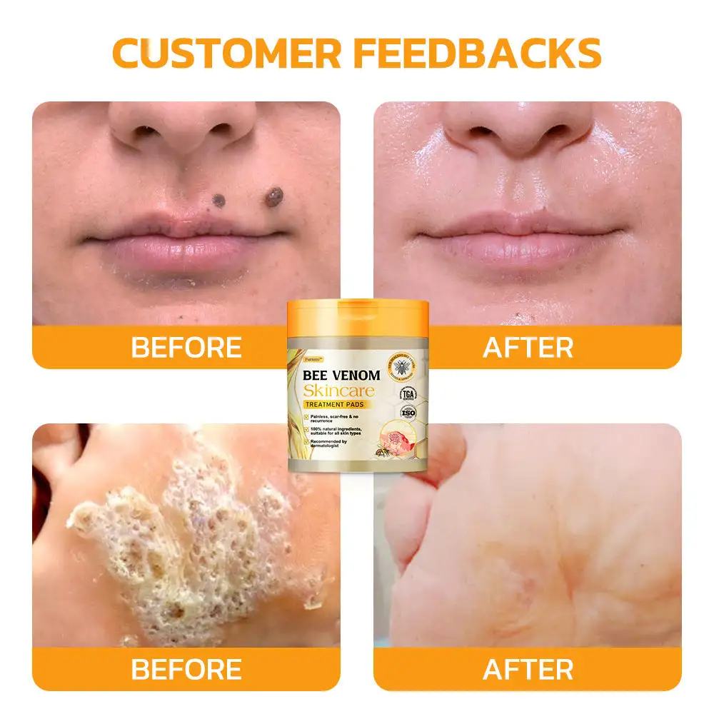 Bee Venom Skincare Treatment Pads - Image 5