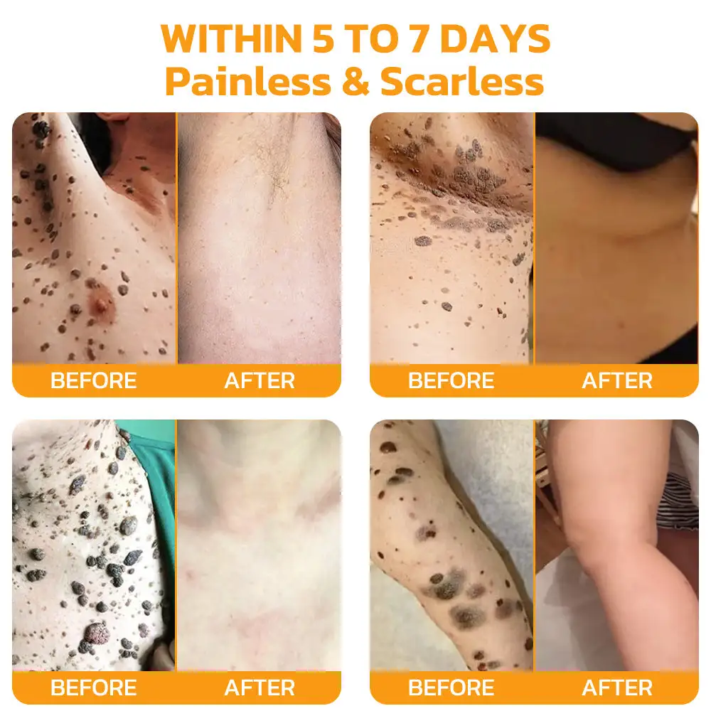 Bee Venom Skincare Treatment Pads - Image 6