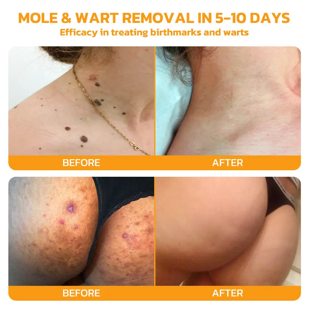 Bee Venom Skincare Treatment Pads - Image 7