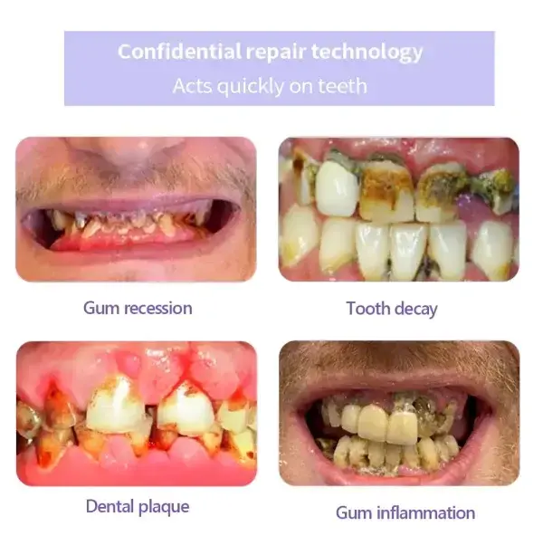 Teeth Restoration Mineral Powder - Image 9