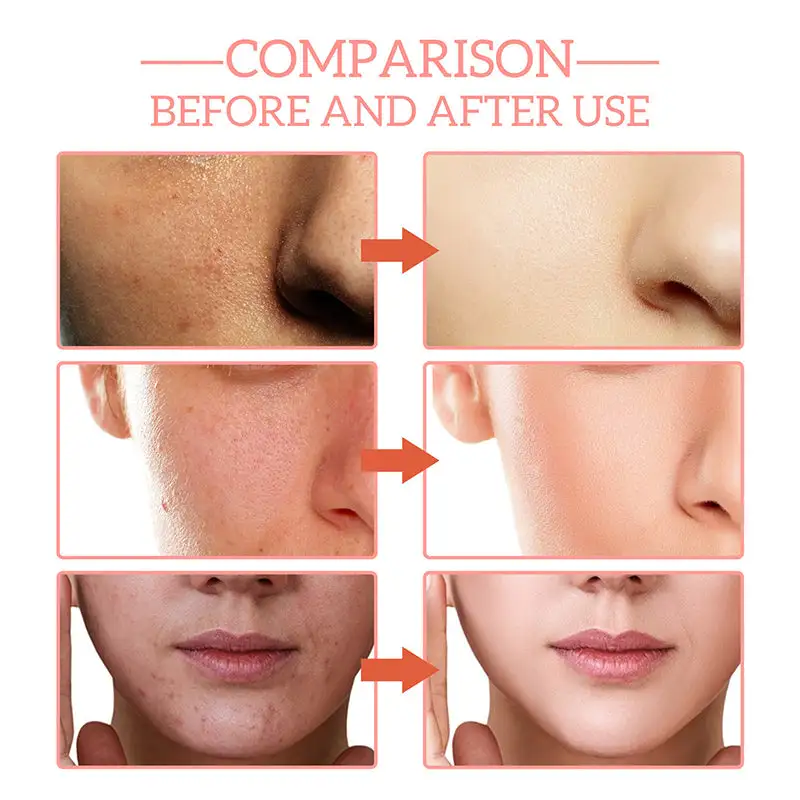 5-in-1 facial care - Image 5