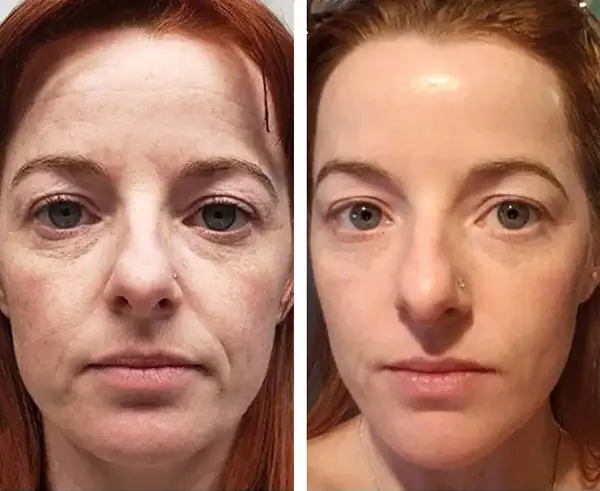 5-in-1 facial care - Image 7