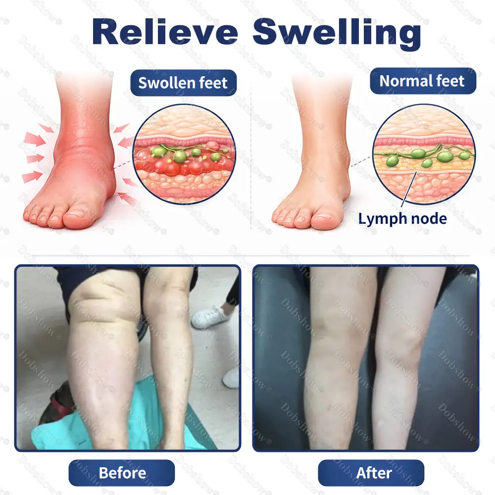 Advanced Edema Relief Cream - Image 4