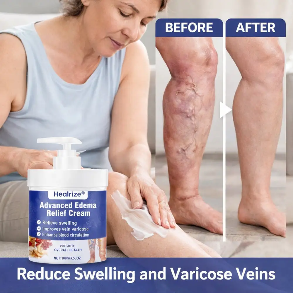 Advanced Edema Relief Cream - Image 5