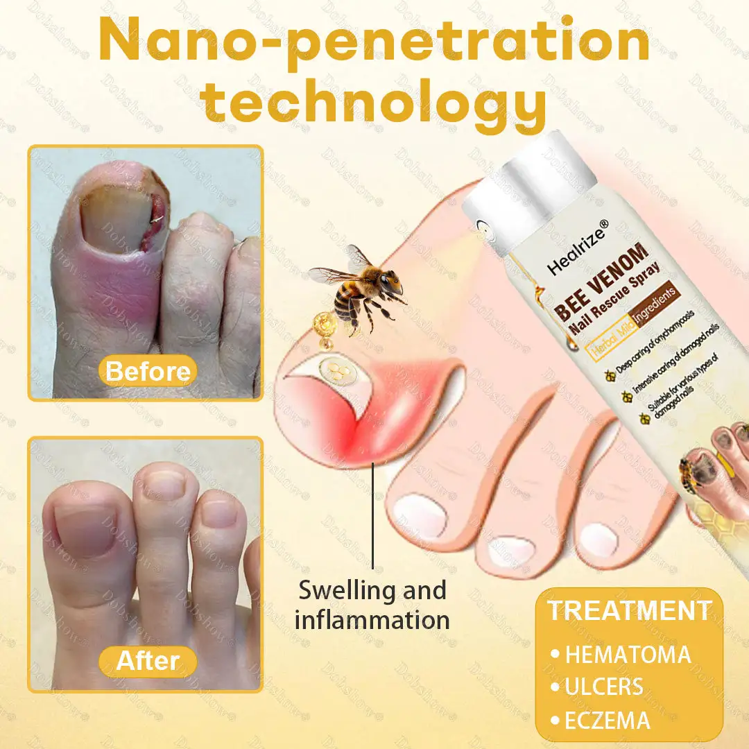 Bee Venom Nail Rescue Spray - Image 6