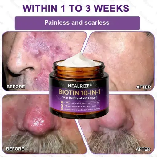 Biotin 10-in-1 Skin Restoration Cream - Image 10
