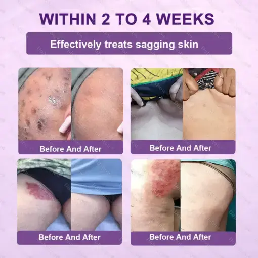 Biotin 10-in-1 Skin Restoration Cream - Image 8