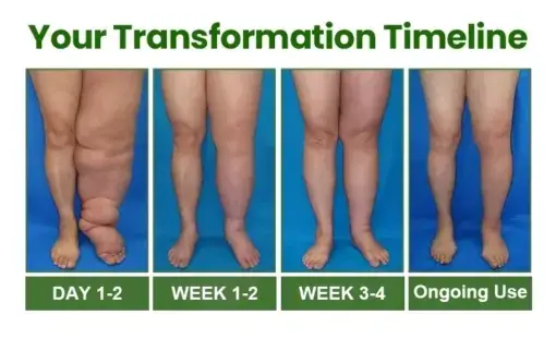 Light Legs Swelling & Circulation Relief Spray - Image 7