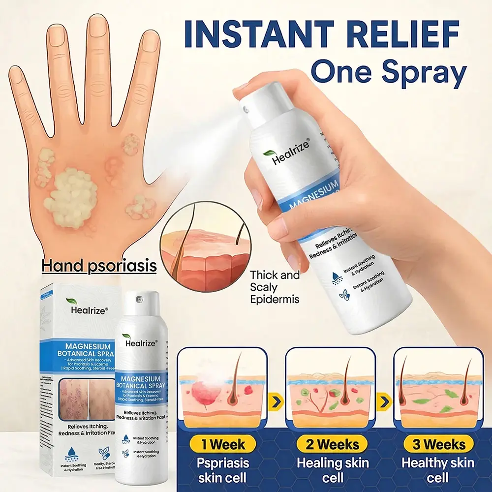 Magnesium Botanical Spray –Advanced Skin Recovery for Psoriasis & Eczema - Image 10