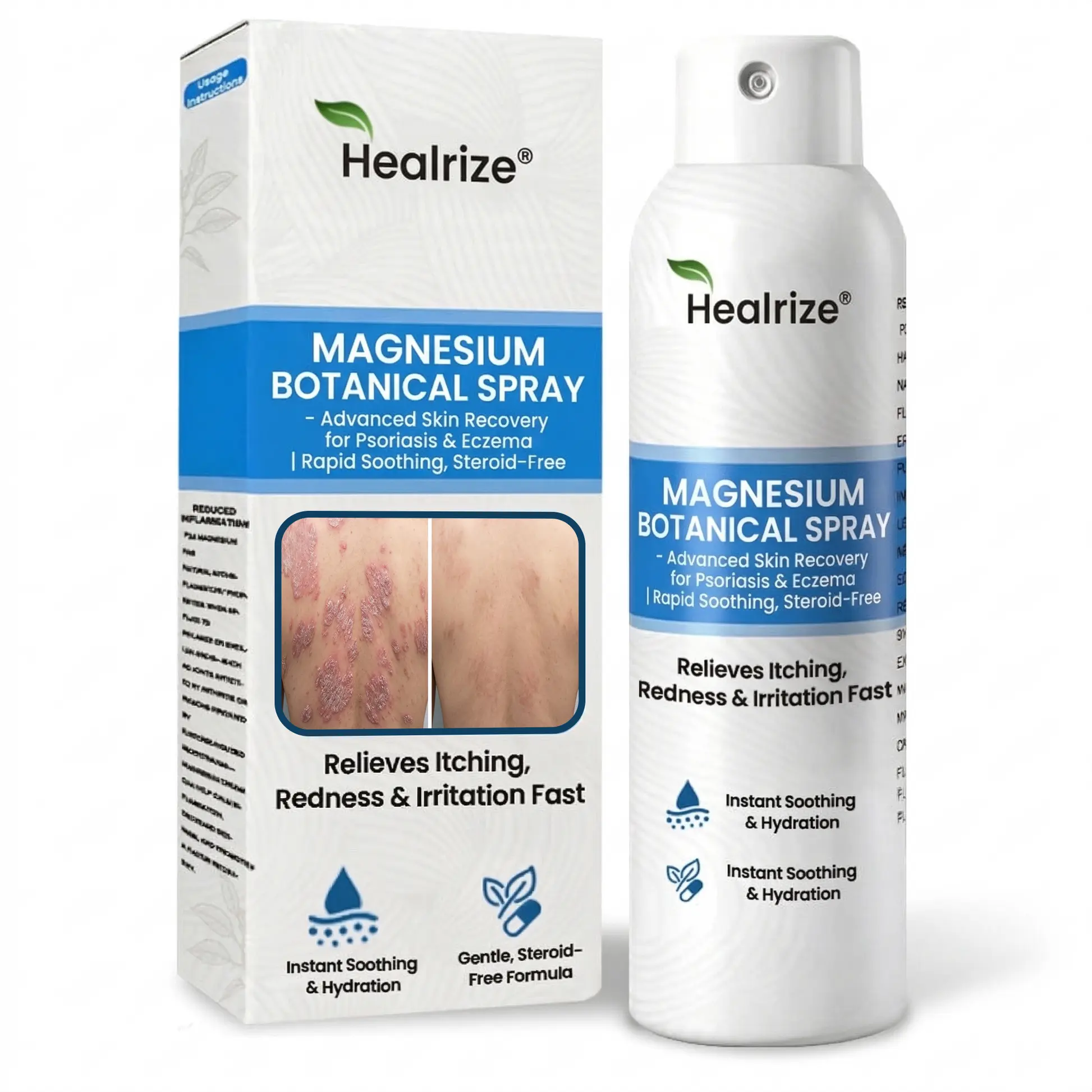 Magnesium Botanical Spray –Advanced Skin Recovery for Psoriasis & Eczema - Image 11