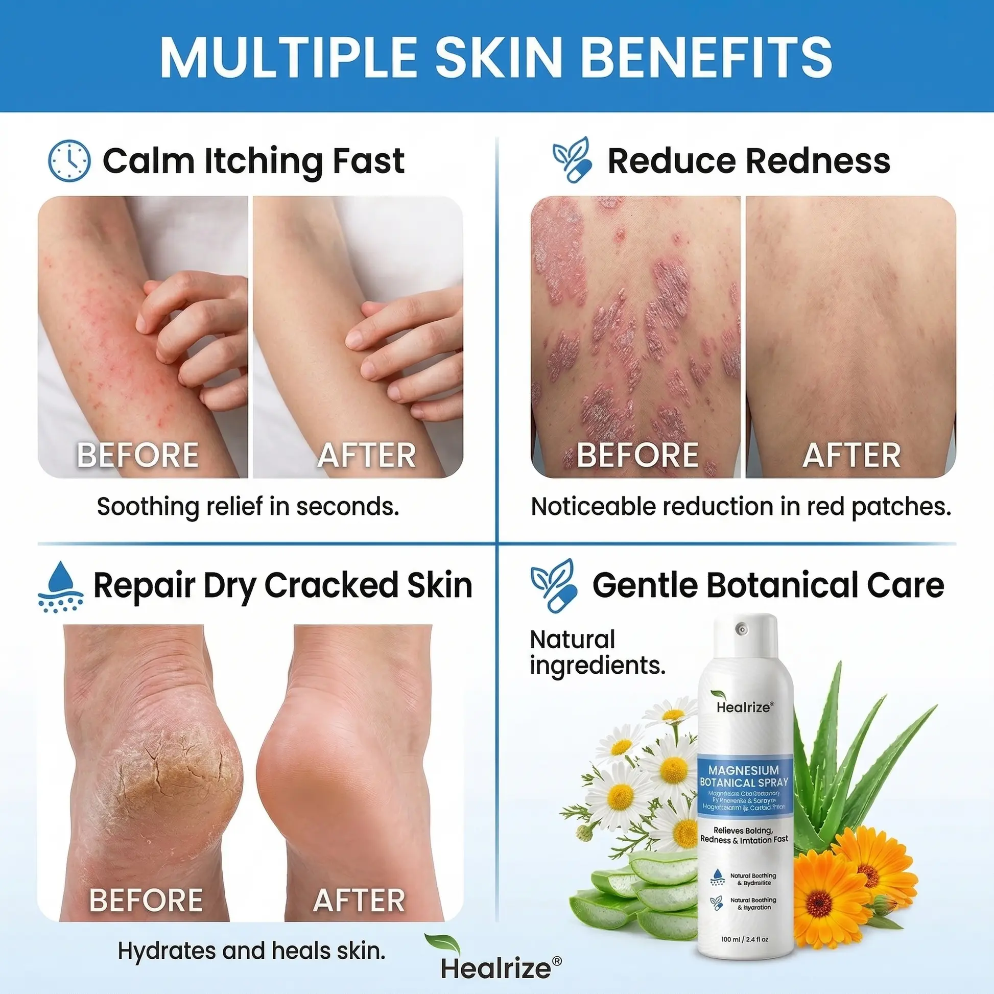 Magnesium Botanical Spray –Advanced Skin Recovery for Psoriasis & Eczema - Image 9