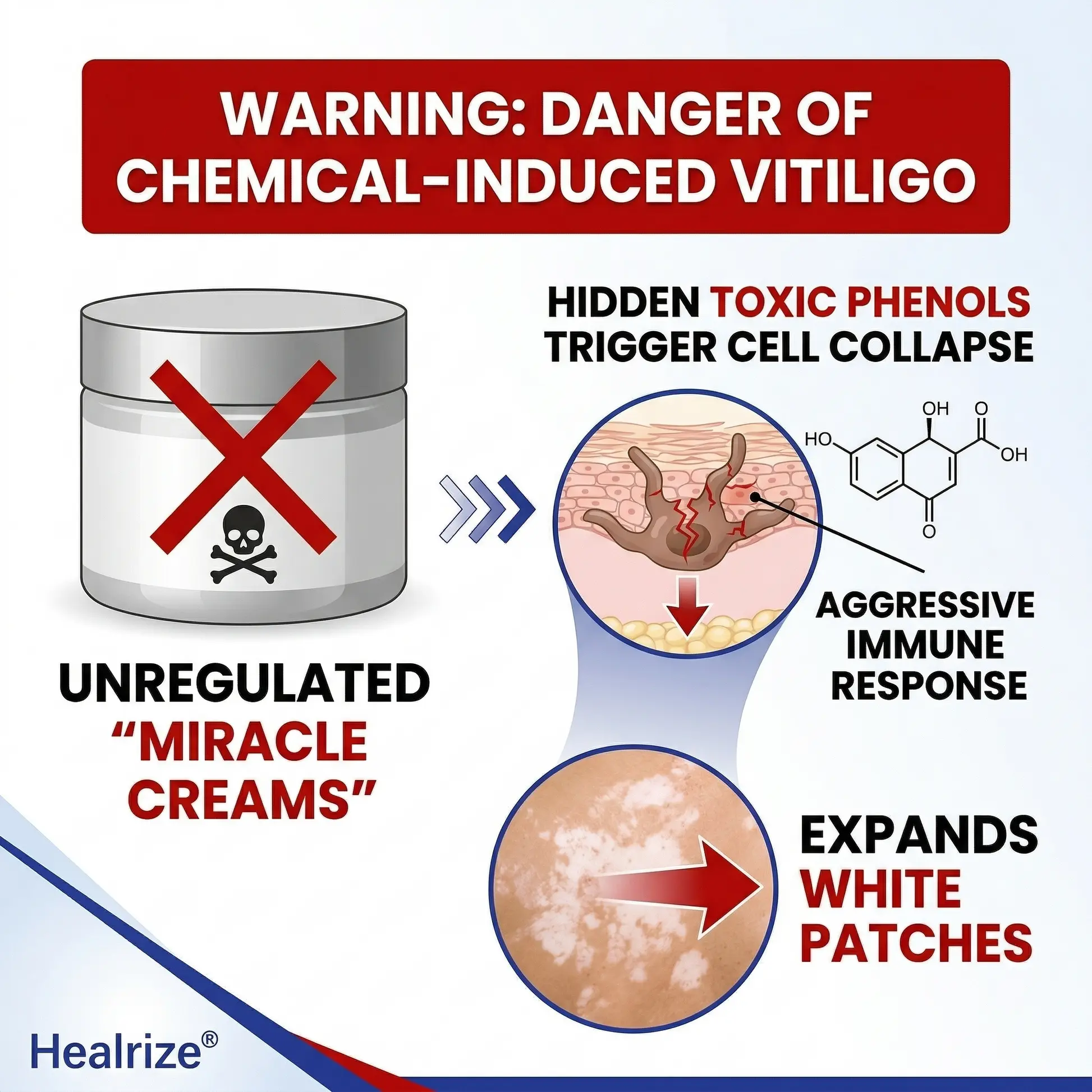 Rapid Repair Vitiligo Essence - Image 10