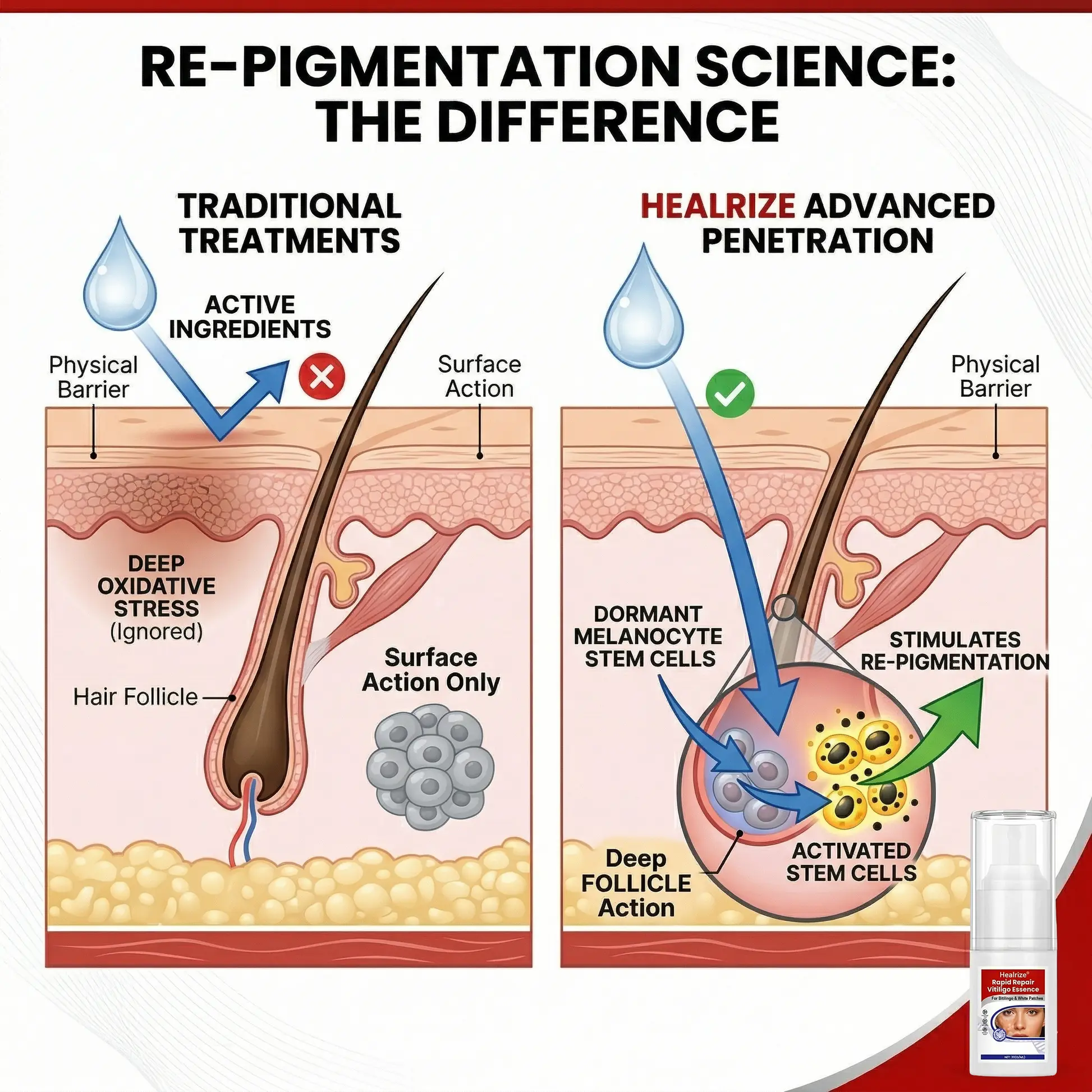 Rapid Repair Vitiligo Essence - Image 11