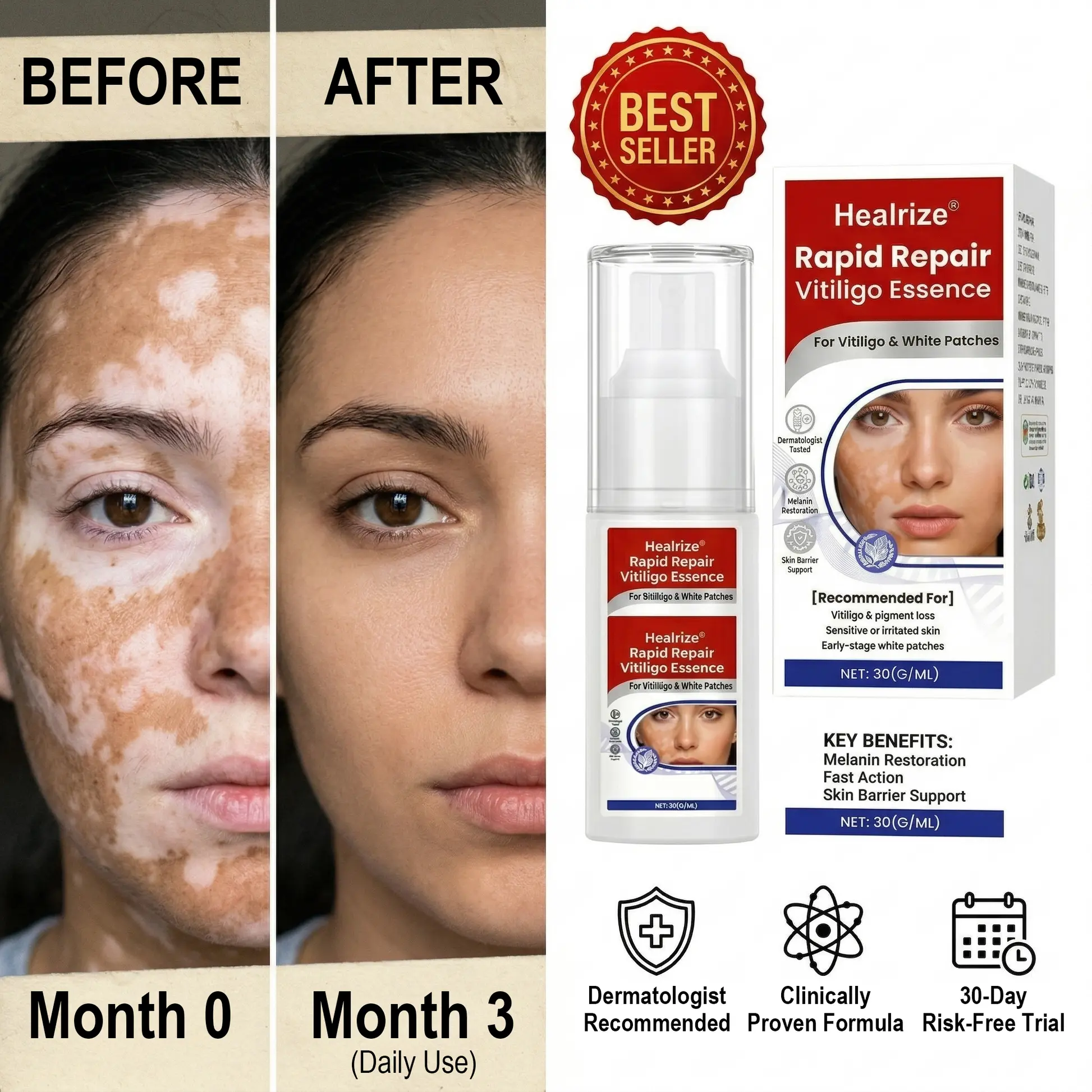 Rapid Repair Vitiligo Essence - Image 8
