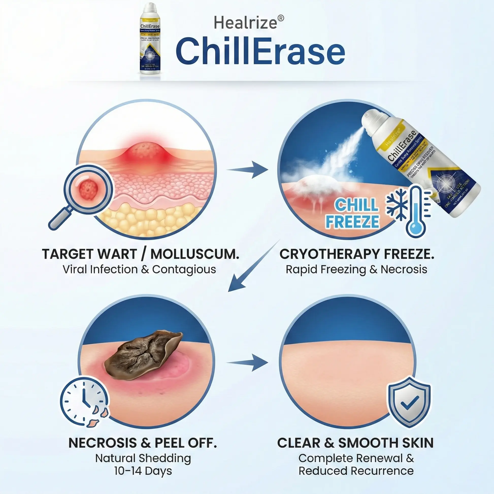 ChillErase Gentle Bump Renewal Spray—Stubborn Skin Bumps & Rough Spots - Image 4