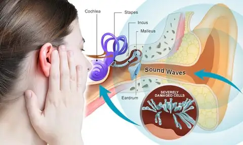 Tinnitus Treatment Ear Patch - Image 3