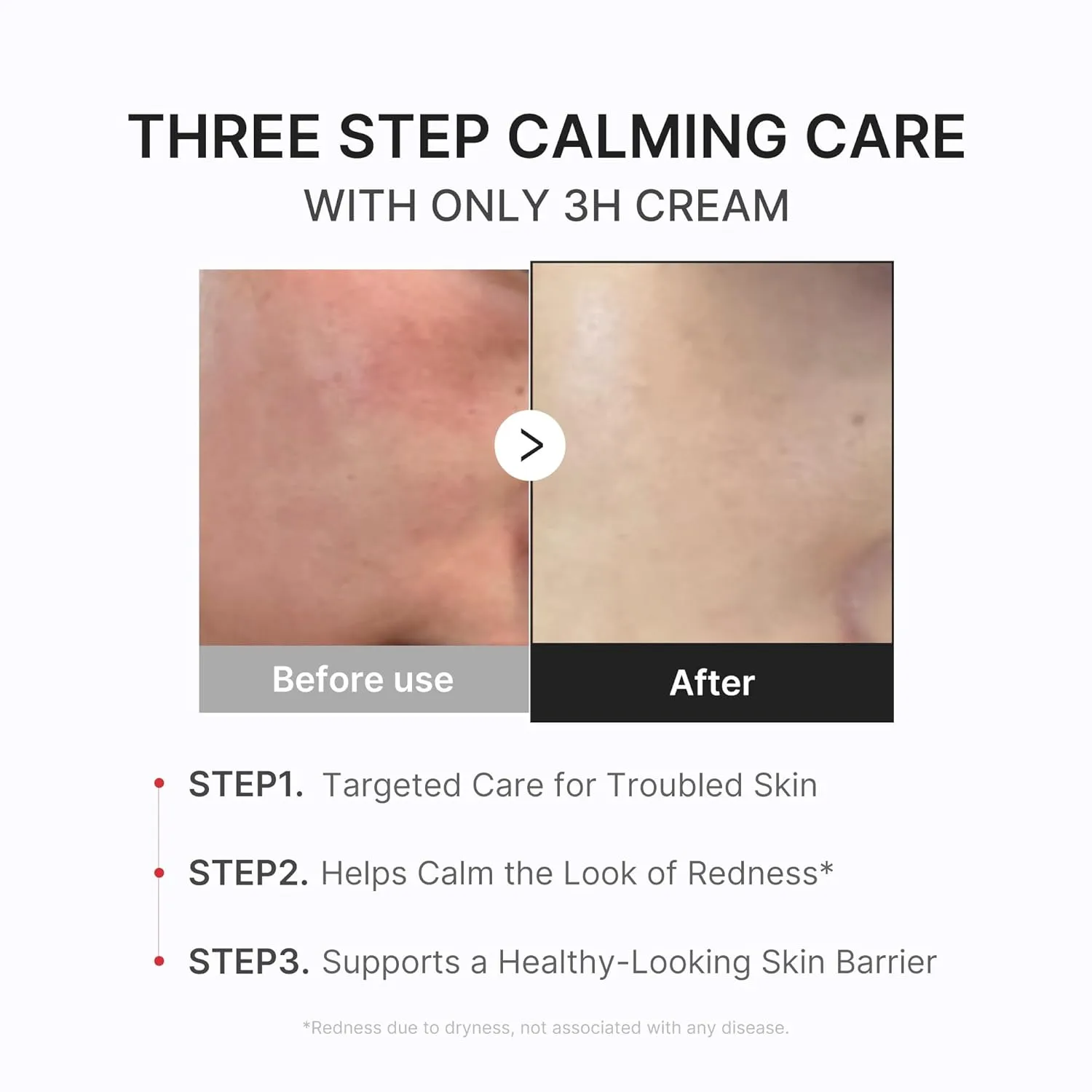 KLENIMORE 3H Daily Relief Cream - Guaiazulene & Centella Soothing Moisturizer for Sensitive Skin - Image 5