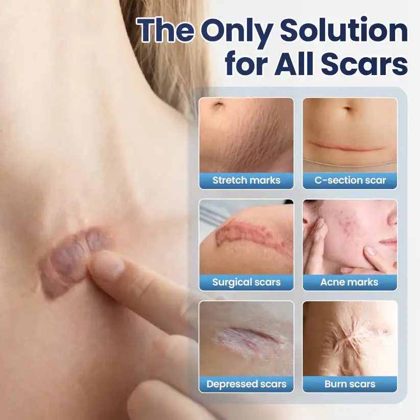 Texture Repair Gel - Image 4